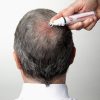 stem cell hair growth factors equipment