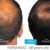 Advanced Hair & Scalp Fitness Program - Image 3