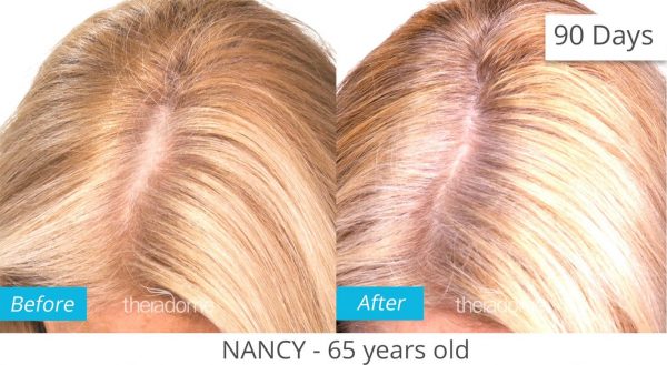 Advanced Hair & Scalp Fitness Program - Image 4