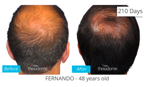 Before-and-After-Tile.jpg